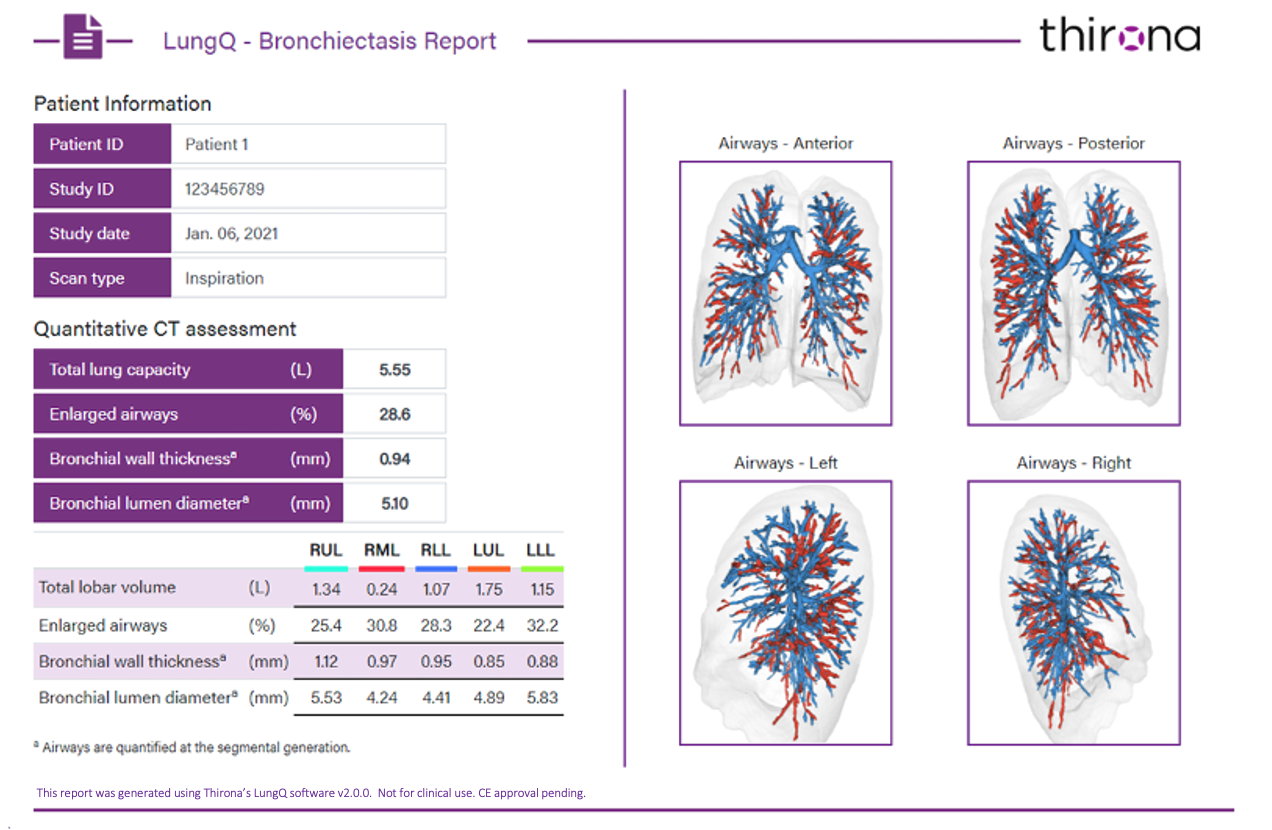 Thirona-LungQ-lung-CT-image-analysis-Bronchiectasis-RSNA-2021