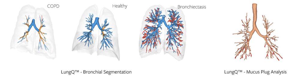 Bronchial segmentation and mucus plug count