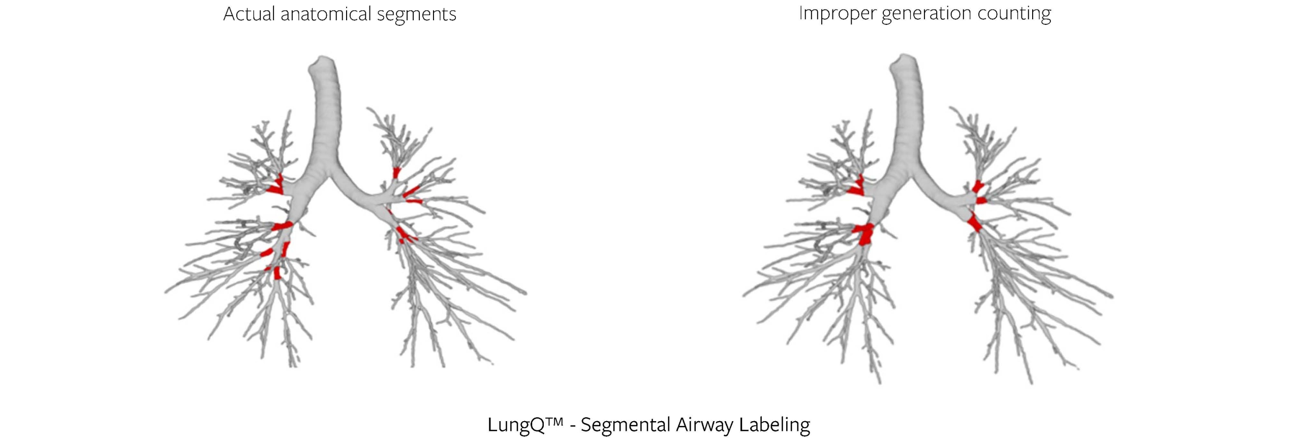 Segmental bronchial generation labeling algorithm