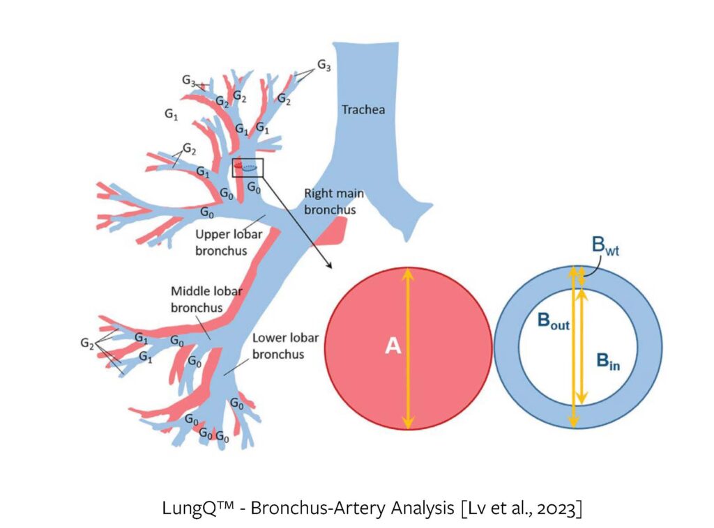 Bronchus-artery analysis algorithm measurements