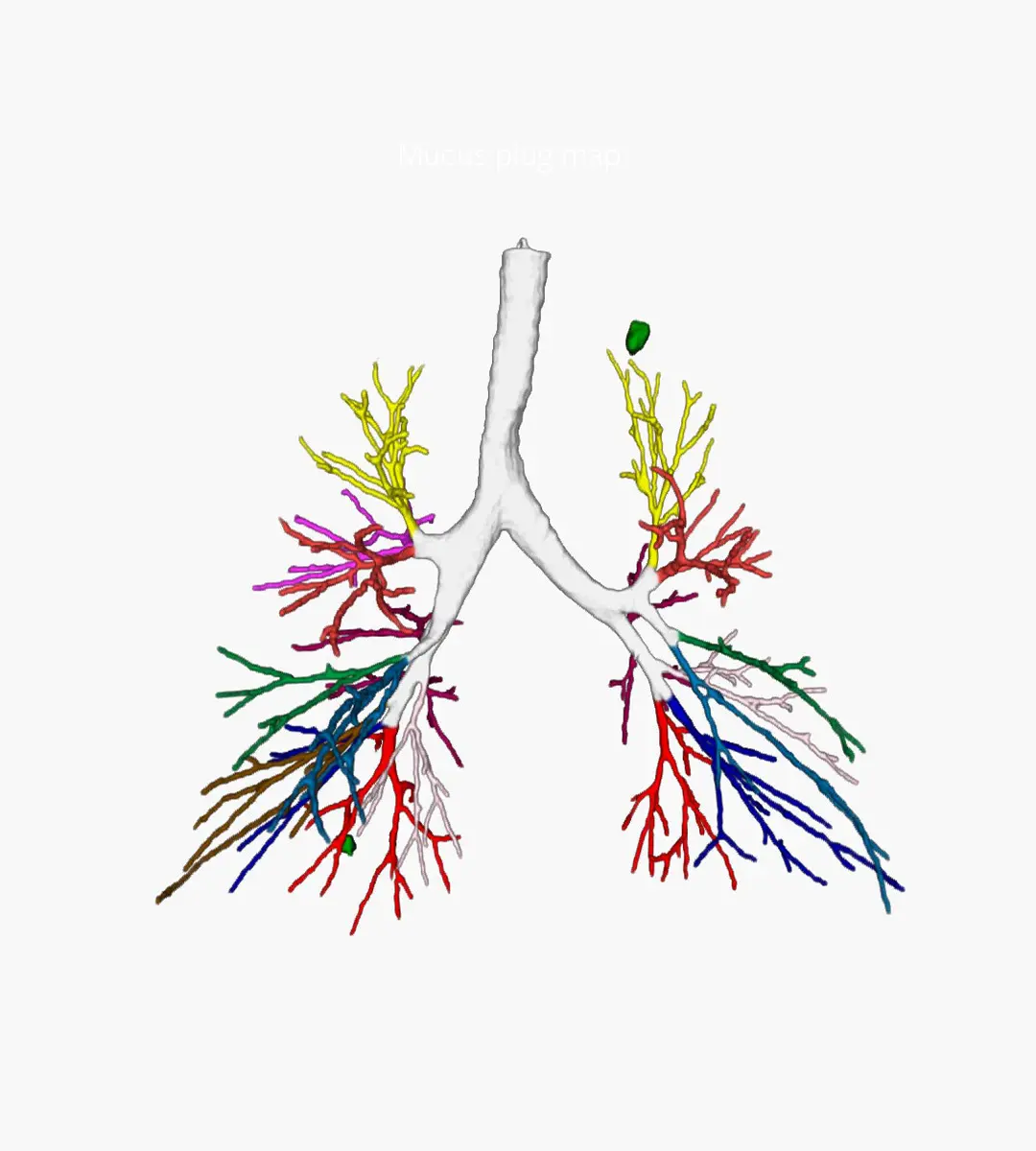 Lung nodule localization targeting
